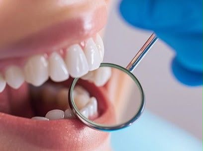 Ortodontia Preventiva